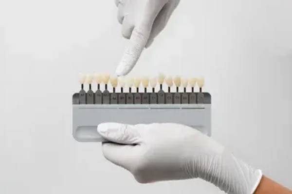 Full Ceramic Crowns