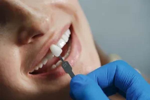 Zirconia Crowns