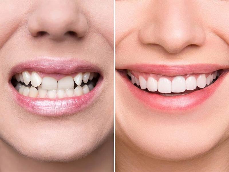 Smile Design Expertise