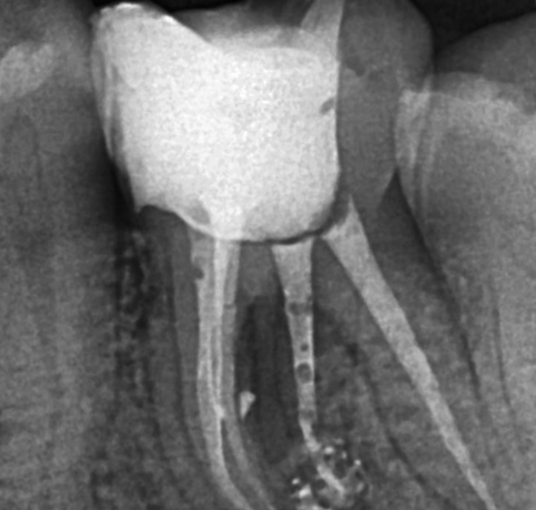 teeth xray